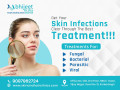best-dermatologist-in-patna-by-dr-abhijeet-kumar-jha-with-experience-doctor-small-0