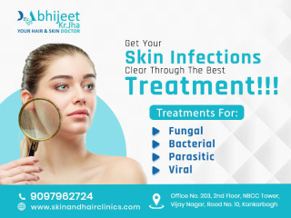 Best Dermatologist In Patna: Your Solution to Healthy, Glowing Skin